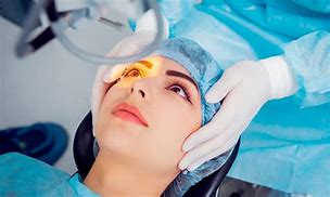 Image result for Laser Eye Surgery