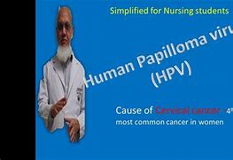 Image result for Human Papilloma Symptoms
