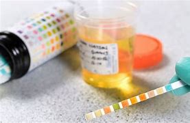 Image result for Rosenbach Test Urine