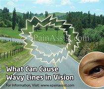 Image result for Waves in Vision