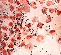 Image result for Gonorrhea Bacteria