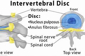 Image result for intervertebral