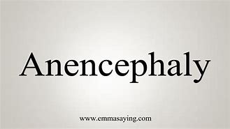 Image result for Anencephaly Adult