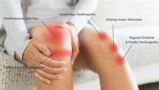 Image result for Long-Term Relief for Knee Pain