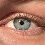 Image result for Girl with Rare Eye Color