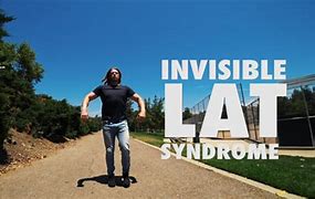 Image result for Kid Invisible Lat Syndrome