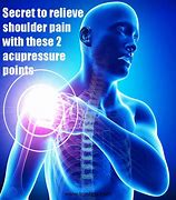Image result for Shoulder Pain Acupuncture Points