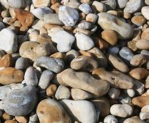 Image result for Gallstone