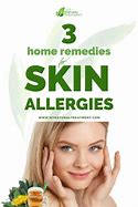 Image result for Skin Allergies Home Remedies