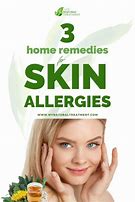 Image result for Skin Allergy Rash Treatment