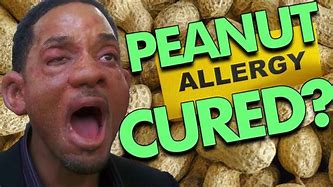 Image result for Allergy Free Peanuts