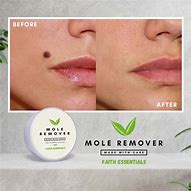 Image result for Kulugo Removal Cream