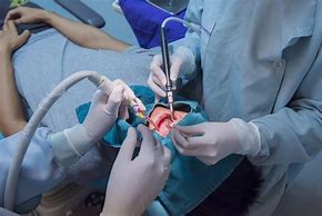 Image result for Teeth Oral Surgery