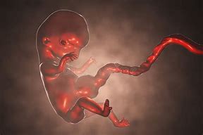 Image result for Human Embryo 8 Weeks