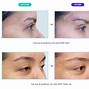 Image result for Cat Eyebrow Lift