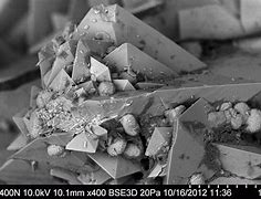 Image result for Kidney Stone Under a Microscope