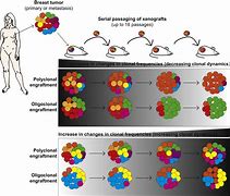 Image result for Cancer Stem Cell Model