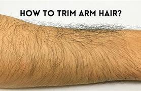Image result for Arm Hair
