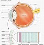 Image result for Astigmatism Real Eye