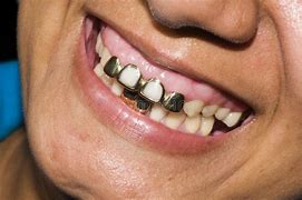 Image result for Hood Art with Gold Teeth