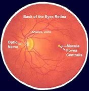 Image result for Normal Retina Right and Left Eye