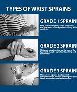 Image result for Types of Wrist Injuries
