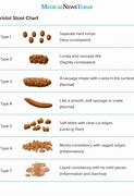 Image result for Pebble Size Chart
