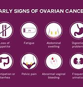 Image result for Ovarian Cyst Warning Signs