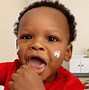 Image result for Topical Corticosteroid Cream