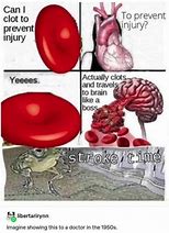 Image result for Signs of a Stroke Memes