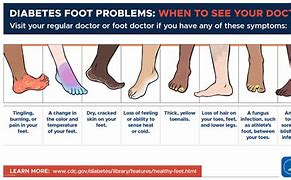 Image result for Diabetic Foot Problems Diabetes