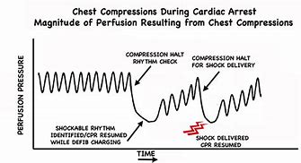 Image result for Recover CPR for Signature