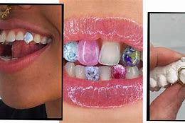 Image result for Nicki Minaj Grillz