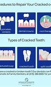 Image result for Broken Teeth
