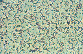 Image result for diplococcus_pneumoniae