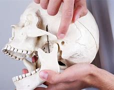 Image result for Jaw Joint Pain One Side