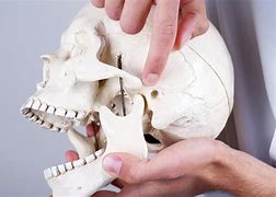 Image result for Jaw Bone Pain