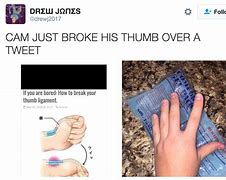 Image result for Ripped Thumb Meme