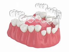 Image result for Invisible Aligners