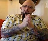 Image result for Jackson Galaxy Before Surgery
