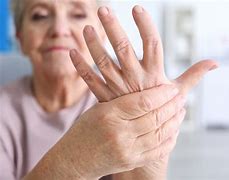 Image result for artritis