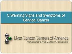 Image result for Signs N Symptoms of Cervical Cancer