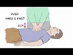 Image result for CPR Animated