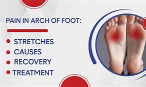 Image result for Pain in Foot Arch Area