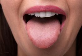 Image result for Papilloma Tongue