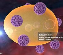 Image result for Genital Human Papillomavirus 16 and 18