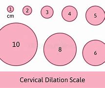 Image result for Dilatation of Cervix