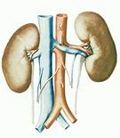 Image result for abst3rsi�n