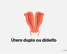 Image result for didelfo