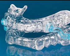 Image result for Sleep Apnea Dental Appliance